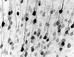 Umprogrammierte Neuronen
