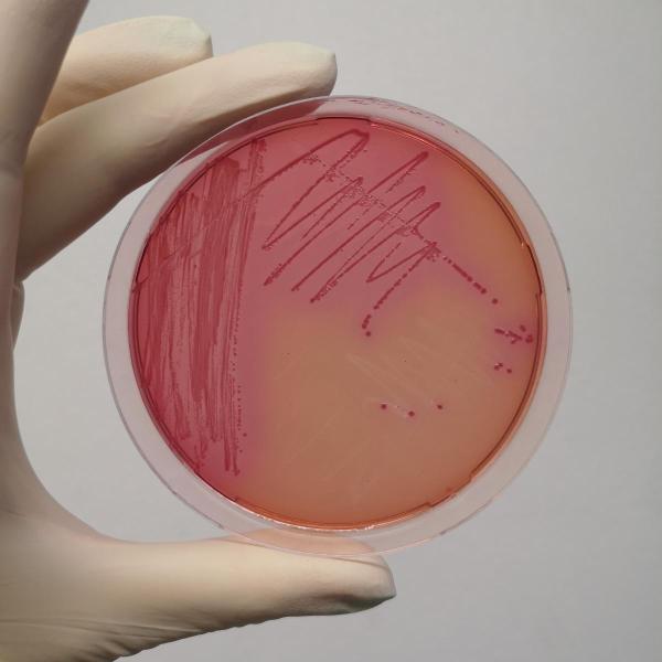 e.-coli-bakterien
